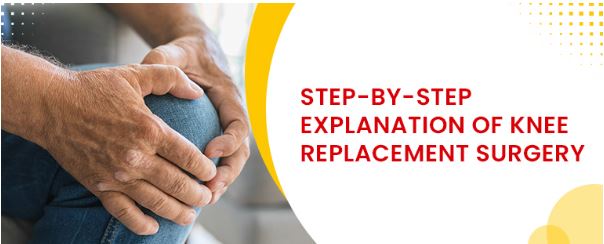 step by step guide on knee replacement surgery
