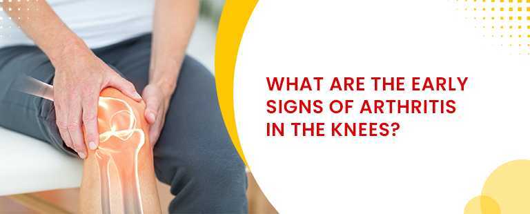 What Are The Early Signs Of Arthritis In The Knees?